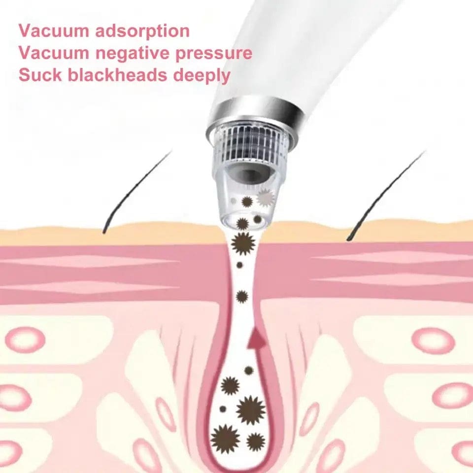 Black Spot Suction Vacuum, Blackhead Remover Cleaning Device, Electric Facial Pore Cleaner, Skincare Exfoliating Beauty Device, Facial Pore Acne Pimple Cleaner, Facial Tag Vacuum Suction, Household Professional Facial Pore Pimple Cleanser