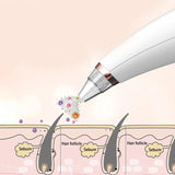 Electric Vacuum Pore Cleaner,  6 In 1 Blackheads Removing Device, Facial Black Spots White Dot Pimple Acne Cleaner, Beauty Extractor Skin Care Tools, Black Point Vacuum Suction Device, USB Rechargeable Bubble Beauty Instrument