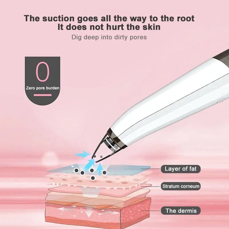 Black Spot Suction Vacuum, Blackhead Remover Cleaning Device, Electric Facial Pore Cleaner, Skincare Exfoliating Beauty Device, Facial Pore Acne Pimple Cleaner, Facial Tag Vacuum Suction, Household Professional Facial Pore Pimple Cleanser