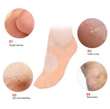 Heel Protector Gel Socks, Anti Crack Foot Spa Socks, Moisturizing Silicone Socks, Foot Care Gel Socks