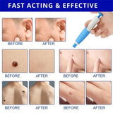 Skin Tag Remover, 2 In1 Painless Auto Skin Tag Remover, Mole Wart Removal Kit, Micro Skin Tag Remover