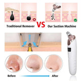 Blackhead Removal Machine – Skin Care & Pore Cleaner
