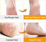 Pair Of Silicone Boat Heel Insole, Silicone Moisturizing Gel Sock, Anti Crack Protective Insole, Soft Open Toe Socks For Foot Care Protector, Shallow Boat Sock for Girls Ladies, Nonslip Gel Moisturizing Socks Foot Care