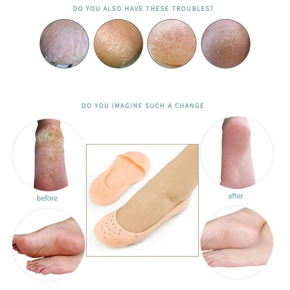 Full Silicon Gel Socks, Anti Crack Heel Socks, Moisturizing Socks For Foot Care And Heel, Full Length Silicone Foot Protector, Cracked Heel Treatment Socks, Men And Women Gel Heel Protectors