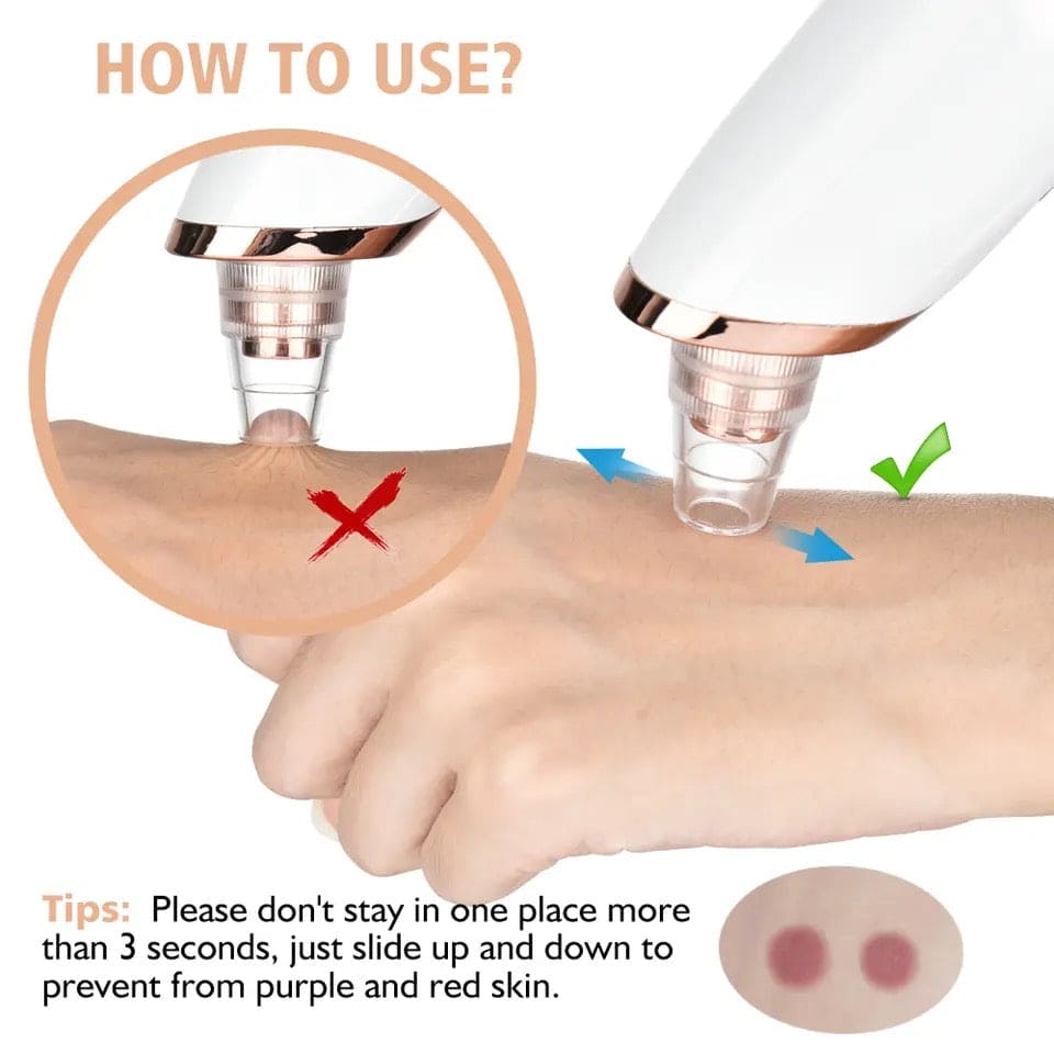 Electric Blackhead Remover, Vacuum Acne Cleaner, Black Spots Removal Device, Pore Cleaner Machine, Skin Care Tools, 5 Heads Suction Machine,  Vacuum Electric Black Head Extractions Tool, Electric Facial Pore Cleaner, Exfoliating Beauty Device