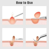 Set Of 4 Pimple Popper Needle, 4-In-1 Multifunctional Acne Needles, Blackhead Remover Tools, Spoon Face Skin Care Tools, Steel Blackhead Removal Kit, Women Beauty Acne Treatment Pore Cleanser Needle Hook, Comedone Extractor Remover Set for All Skin Types