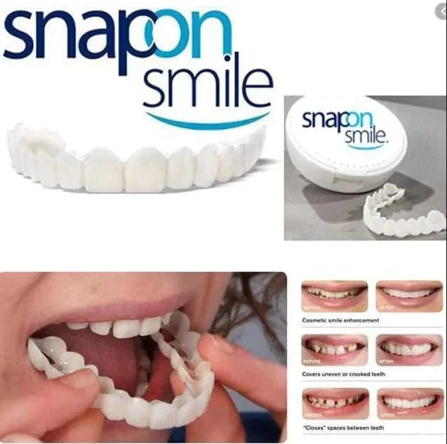 Snap-On Smile Moldable False Teeth Veneers with Artificial Braces Kit for Men & Women – Temporary Cosmetic Dental Solution