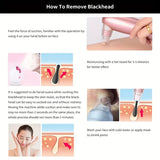 Bubble Black Head Remover, Vacuum Pore Cleaner, Acne Cleanser, Black Spots Removal, Face Nose Deep Cleaning Tools, Pimple Pore Cleansing Device, Beauty Skin Care Tool, 5 Sensors USB Rechargeable Blackhead Vacuum Cleaner Kit for Women and Men